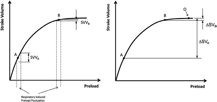 Change in stroke volume can be used to determine where a patient lies on the Frank–Starling curve.  The curve of a patient with low preload, and hence larger changes with volume, is seen in panel A; changes in preload in a patient who is optimized are seen in panel B.  Stroke volume variation (SVV); O indicates the optimal operating point. (Image source Figure 1 from article.)
