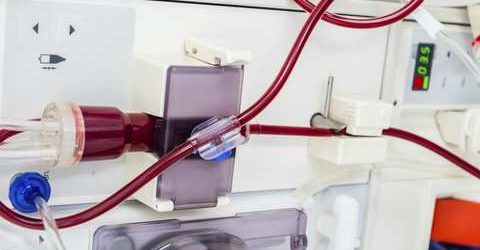 Fluid therapy for kidney transplant surgery